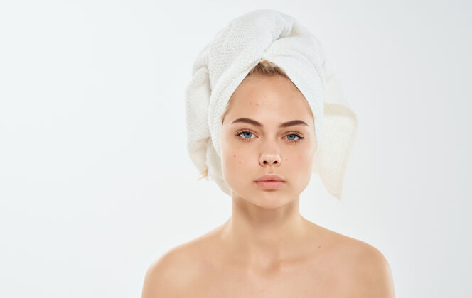 护理女人用毛巾在她的头上赤裸的肩膀湿头发的问题 我们面对的皮肤特写女士治疗