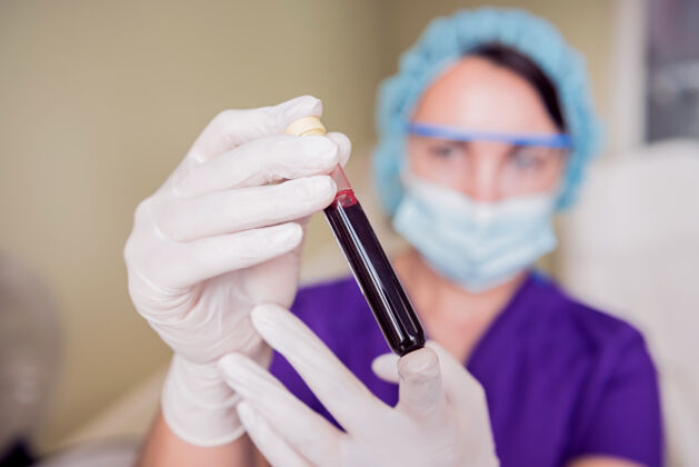 生物技术富血小板血浆制备管手上有血支架研究医生