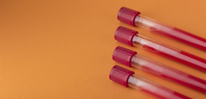 实验室血样分类在橙色上医疗排列成分