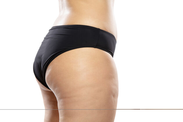 大腿超重的女人腿部和臀部有脂肪团 肥胖的女人身体穿着黑色内衣运动饮食减肥
