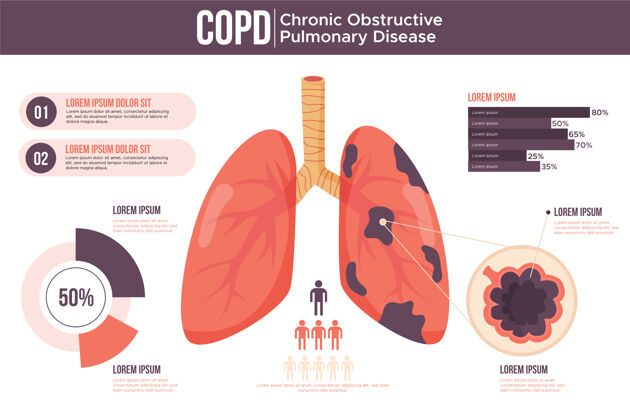 呼吸器平面设计copd资讯图检查健康炎症